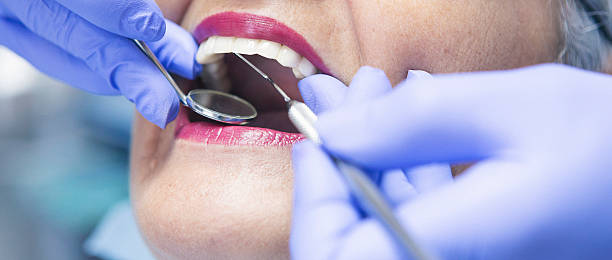 Best Knocked-Out Tooth (Avulsed Tooth) Treatment in Augusta, AR